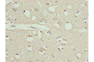Immunohistochemistry of paraffin-embedded human brain tissue using ABIN7146563 at dilution of 1:100