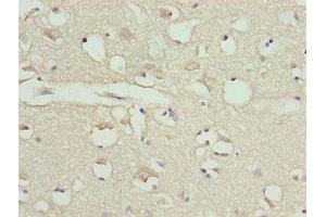 Immunohistochemistry of paraffin-embedded human brain tissue using ABIN7146563 at dilution of 1:100 (Calreticulin anticorps  (AA 18-415))