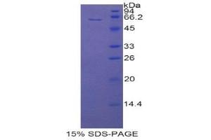 SDS-PAGE (SDS) image for CD5 Molecule-Like (CD5L) (AA 11-346) protein (His tag,GST tag) (ABIN1877855)