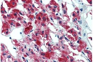 Adrenal, Human: Formalin-Fixed, Paraffin-Embedded (FFPE) (IL23A anticorps)