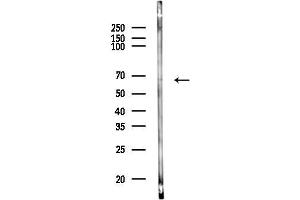 Western blot analysis of lysates from Mouse lung, using Acetyl-NF-kappaB p65 (Lys310) Antibody at 1/1000 dilution.