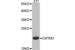 Western blot analysis of extracts of 231 cell line, using CMTM3 antibody. (CMTM3 anticorps)