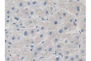 IHC-P analysis of Human Liver Tissue, with DAB staining. (GRK4 anticorps  (AA 187-449))
