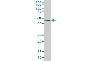 HNRNPG-T monoclonal antibody (M01), clone 6F11 Western Blot analysis of HNRNPG-T expression in HeLa . (RBMXL2 anticorps  (AA 1-90))