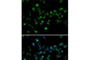 Immunofluorescence analysis of MCF7 cells using MORF4L1 Polyclonal Antibody (MORF4L1 anticorps)