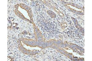 IHC analysis of GRPEL1 using anti-GRPEL1 antibody (ABIN7602643). (GRPEL1 anticorps  (AA 90-217))