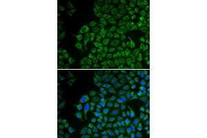 Immunofluorescence analysis of U2OS cells using TYR antibody.