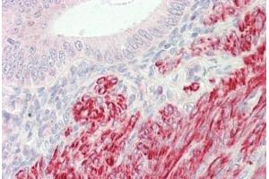 Human Uterus: Formalin-Fixed, Paraffin-Embedded (FFPE) (INPP5K anticorps  (AA 183-430))