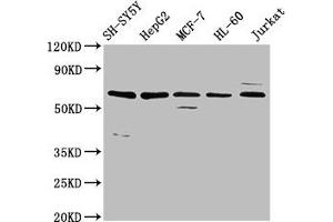Western Blot Positive WB detected in: SH-SY5Y whole cell lysate, HepG2 whole cell lysate, MCF-7 whole cell lysate, HL-60 whole cell lysate, Jurkat whole cell lysate All lanes: HRG antibody at 4.