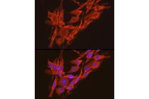 Immunofluorescence analysis of PC-12 cells using CSNK2 Rabbit pAb (ABIN3022252, ABIN3022253, ABIN3022254 and ABIN6218695) at dilution of 1:100 (40x lens).