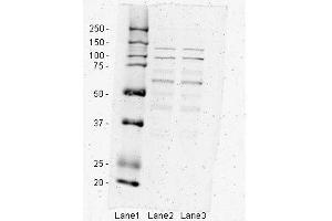 Sample Type: Primary vascular endothelial cellsProtocol: Loaded 30ug of cell lysate of each.
