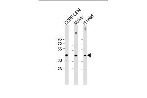 All lanes : Anti-NKX2-5 Antibody (Center) at 1:2000 dilution Lane 1: CCRF-CEM whole cell lysate Lane 2: mouse liver lysate Lane 3: human heart lysate Lysates/proteins at 20 μg per lane. (NK2 Homeobox 5 anticorps  (AA 82-111))