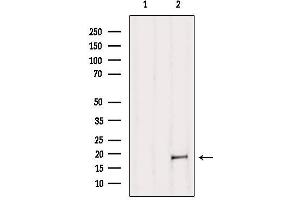 Western blot analysis of extracts from B16F10, using MAX Antibody. (MAX anticorps  (N-Term))