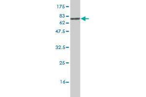 Western Blot detection against Immunogen (70.