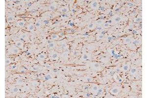 ABIN6272737 at 1/200 staining Rat brain tissue sections by IHC-P. (P2RY12 anticorps  (N-Term))