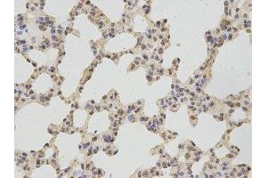 Immunohistochemistry (IHC) image for anti-thromboxane A Synthase 1 (Platelet) (TBXAS1) antibody (ABIN1875427) (TBXAS1 anticorps)