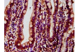 IHC image of ABIN7143295 diluted at 1:500 and staining in paraffin-embedded human small intestine tissue performed on a Leica BondTM system.
