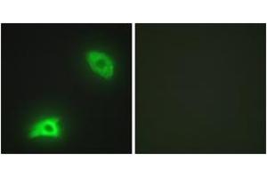 Immunofluorescence analysis of HeLa cells, using DUSP6 Antibody. (DUSP6 anticorps  (AA 61-110))