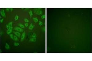 Immunofluorescence analysis of A549 cells, using Stefin A Antibody . (CSTA anticorps  (Internal Region))