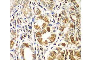 Immunohistochemistry of paraffin-embedded Human gastric using RAC1 Polyclonal Antibody at dilution of 1:100 (40x lens). (RAC1 anticorps)
