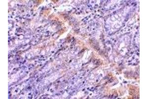 Immunohistochemistry (IHC) image for anti-Golgi-Associated PDZ and Coiled-Coil Motif Containing (GOPC) (Middle Region) antibody (ABIN1031039)