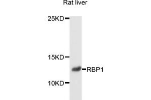 Western blot analysis of extracts of rat liver, using RBP1 antibody (ABIN6003736) at 1/1000 dilution. (RBP1 anticorps)