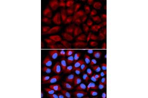 Immunofluorescence analysis of U2OS cell using FANCC antibody. (FANCC anticorps)