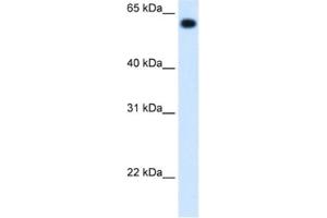 Western Blotting (WB) image for anti-Aldehyde Dehydrogenase 4 Family, Member A1 (ALDH4A1) antibody (ABIN2462884) (ALDH4A1 anticorps)