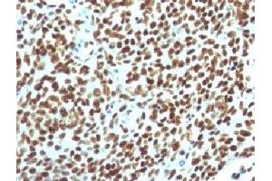 IHC testing of FFPE human tonsil with Nuclear Antigen antibody. (Nuclear Antigen anticorps)