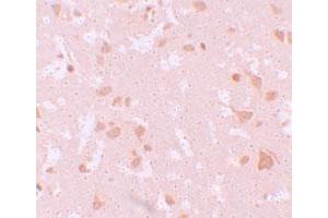 Immunohistochemical staining of human brain cells with NLRP7 polyclonal antibody  at 10 ug/mL. (NLRP7 anticorps  (N-Term))