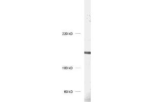 dilution: 1 : 1000, sample: rat hippocampus homogenate (UBE3B anticorps)