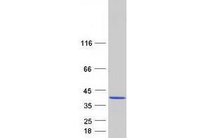 Validation with Western Blot