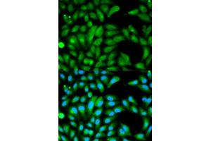 Immunofluorescence analysis of HeLa cell using PARK2 antibody.