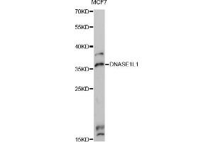 Western blot analysis of extracts of MCF7 cells, using DNASE1L1 Antibody (ABIN6292460) at 1:3000 dilution. (DNASEX anticorps)