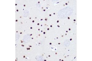 Immunohistochemistry of paraffin-embedded rat brain using USP39 Rabbit mAb (ABIN7271160) at dilution of 1:100 (40x lens).