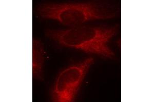 Immunofluorescence staining of methanol-fixed HeLa cells using Phospho-YWHAZ-S58 antibody (ABIN2987575). (14-3-3 zeta anticorps  (pSer58))
