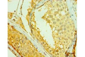 Immunohistochemistry of paraffin-embedded human testis tissue using ABIN7147263 at dilution of 1:100 (RAD1 anticorps  (AA 1-282))