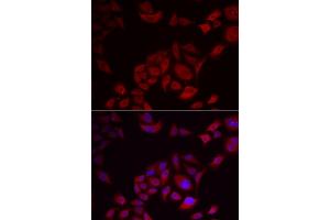Immunofluorescence analysis of U2OS cells using PIKFYVE antibody (ABIN5974035). (PIKFYVE anticorps)