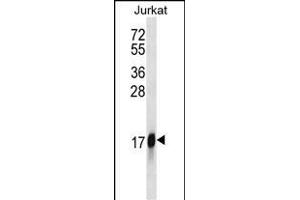 HMGN2 Antibody (N-term) (ABIN1538882 and ABIN2850118) western blot analysis in Jurkat cell line lysates (35 μg/lane). (HMGN2 anticorps  (N-Term))
