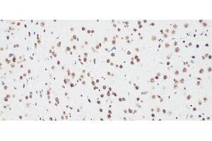 Immunohistochemistry of paraffin-embedded Rat brain using Bcl9 Polyclonal Antibody at dilution of 1:100 (20x lens).