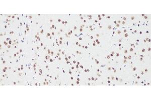 Immunohistochemistry of paraffin-embedded Rat brain using Bcl9 Polyclonal Antibody at dilution of 1:100 (20x lens). (BCL9 anticorps)