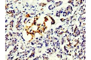 IHC image of ABIN7164077 diluted at 1:300 and staining in paraffin-embedded human pancreatic tissue performed on a Leica BondTM system.