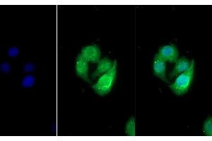 Detection of UMOD in Human Hela cell using Polyclonal Antibody to Uromodulin (UMOD)