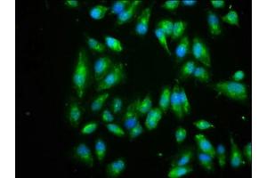 Immunofluorescence staining of Hela cells with ABIN7152162 at 1:266, counter-stained with DAPI. (EIF3I anticorps  (AA 1-323))