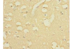 Immunohistochemistry of paraffin-embedded human brain tissue using ABIN7163876 at dilution of 1:100 (WBSCR17 anticorps  (AA 101-300))