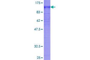 Image no. 1 for Dystrophin (DMD) (AA 1-635) protein (GST tag) (ABIN1351717)