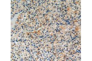 Used in DAB staining on fromalin fixed paraffin- embedded kidney cancer tissue (BCL2L1 anticorps  (AA 2-212))