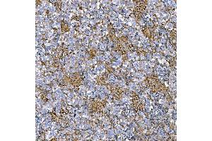 IHC analysis of RAB7/RAB7A using anti-RAB7/RAB7A antibody (ABIN7600597). (RAB7A anticorps  (AA 21-177))