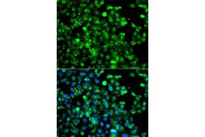 Immunofluorescence analysis of A549 cell using CAPN5 antibody. (Calpain 5 anticorps)