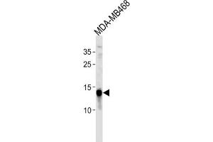 Western Blotting (WB) image for anti-Tumor Protein D52-Like 3 (TPD52L3) antibody (ABIN3004710) (TPD52L3 anticorps)